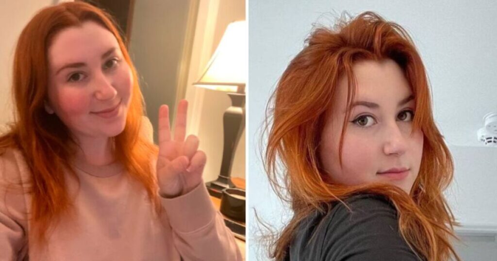  Image of a woman with red hair, one photo showing her smiling and another with a peace sign, illustrating "Adapting To Change: Isla Moon’s Story."